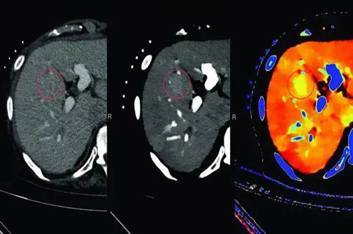 رادیوگرافی رنگی